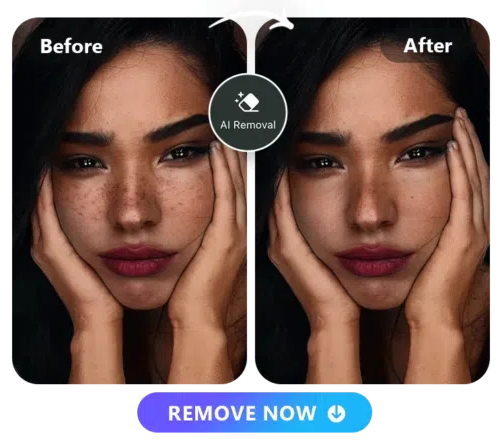 a woman with blemishes on her face photo and the blemishes removed photo side by side